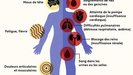 #OnVousRépond : Etat grippal, problèmes pulmonaires et cardiaques, hémorragies… Quels sont les symptômes de l&rsquo;hantavirus ?