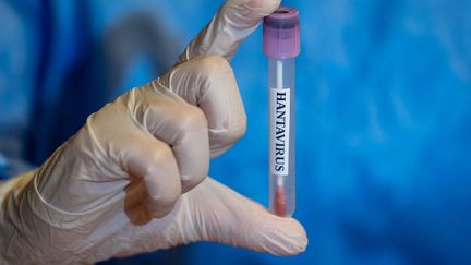 Hantavirus en France : une Française toujours en réanimation, les résultats des tests sur les cas contacts attendus ce jeudi