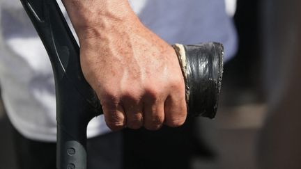 « L&rsquo;impression d&rsquo;avoir une bombe à retardement en moi » : quatre patients racontent leur calvaire après la pose d&rsquo;une prothèse de hernie